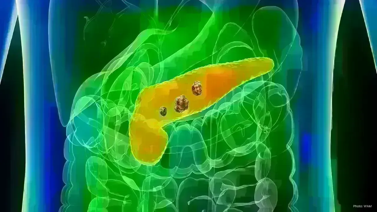 Revolutionary Oral Medication Enhances Survival Rates in Pancreatic Cancer
