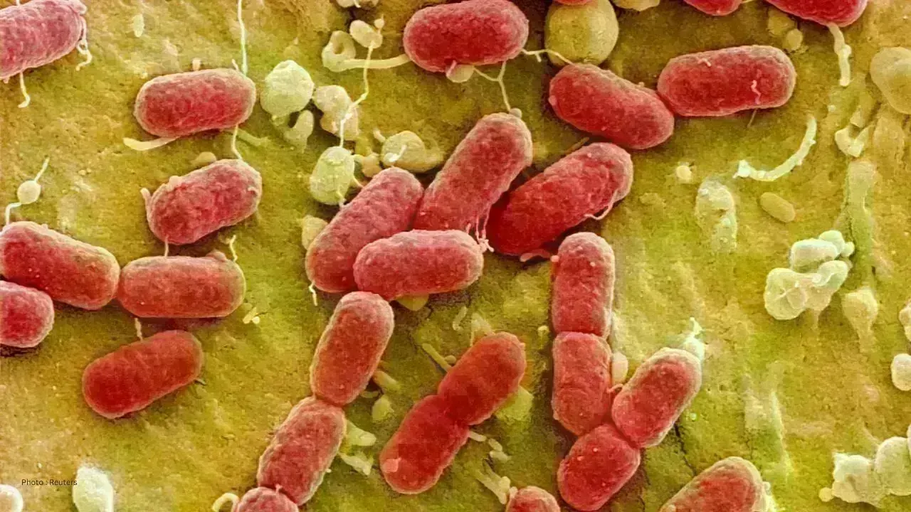Spike in Salmonella Cases Tied to Hamilton Eatery