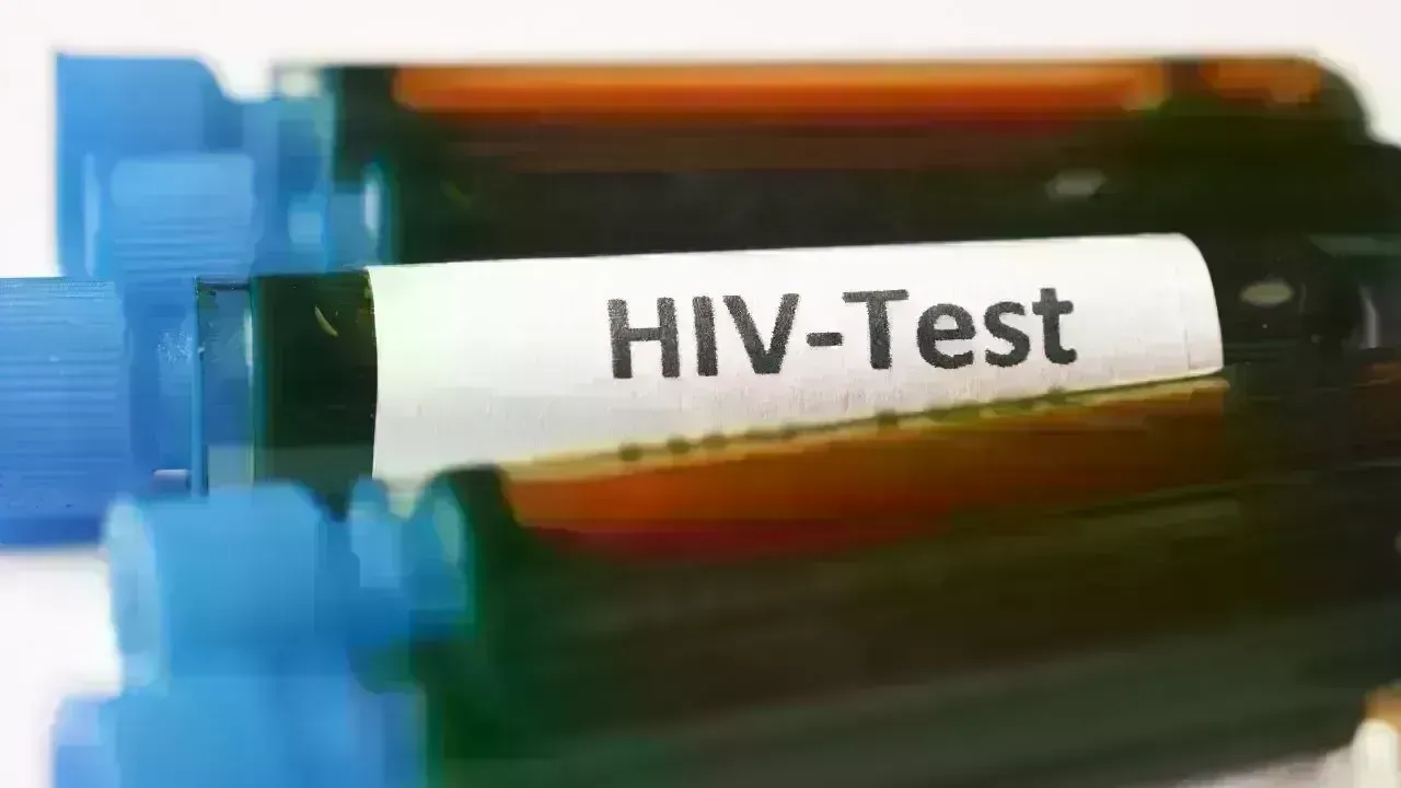 Rising HIV Cases in Chiang Mai Prompt Health Concerns